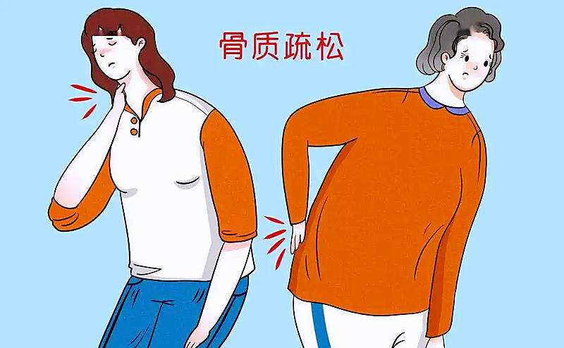 使用骨密度仪判断骨质疏松的风险
